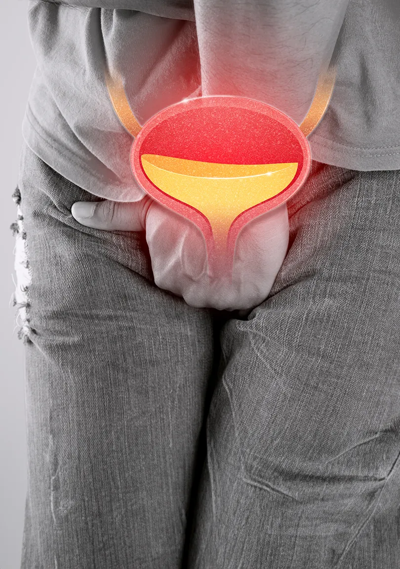 CONTROLE DE INFECÇÕES NO TRATO URINÁRIO