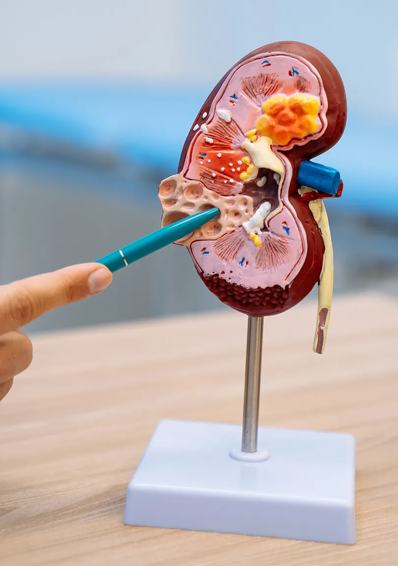 TRATAMENTO INSUFICIÊNCIA RENAL